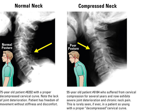 Posture Pump air-cell decompression in use
