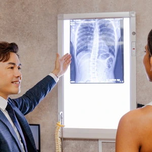 3D postural and spinal X-ray analysis for scoliosis