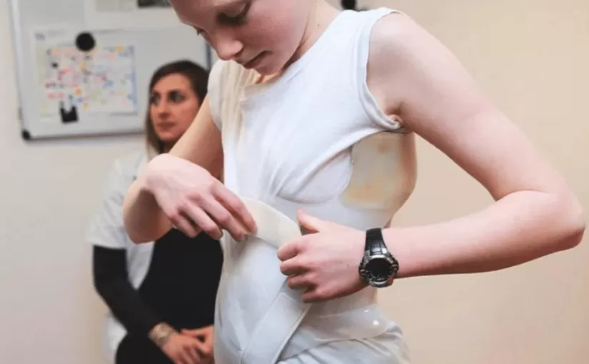 Wie effizient ist ein Stützkorsett bei Skoliose?