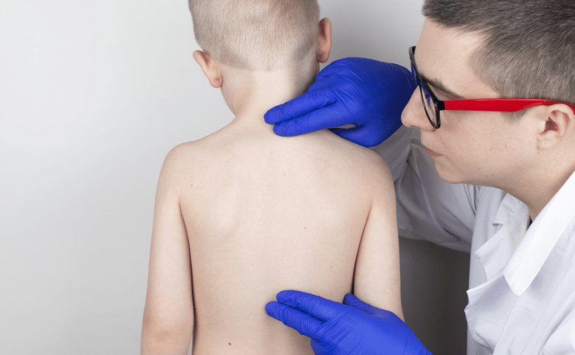 Diagnosis of Scoliosis in Children