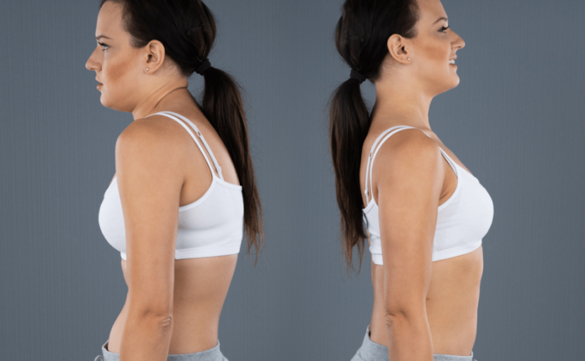 Learn More About Thoracic Hyperkyphosis