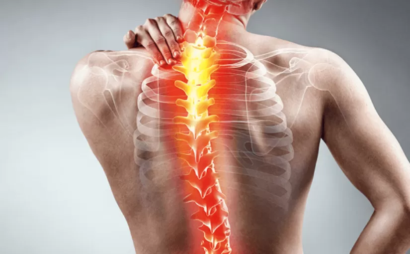 Scoliosi: I rischi della chirurgia spinale