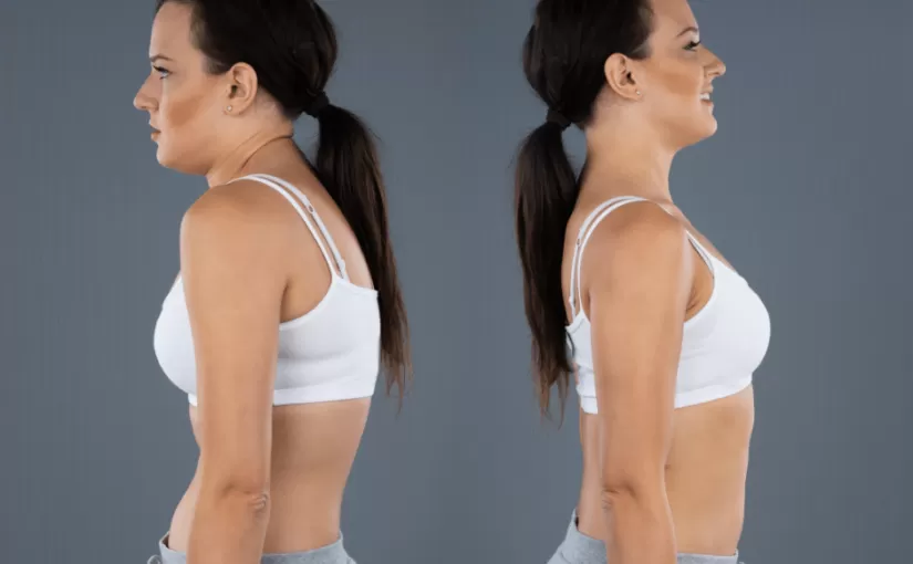 胸椎の過後弯について