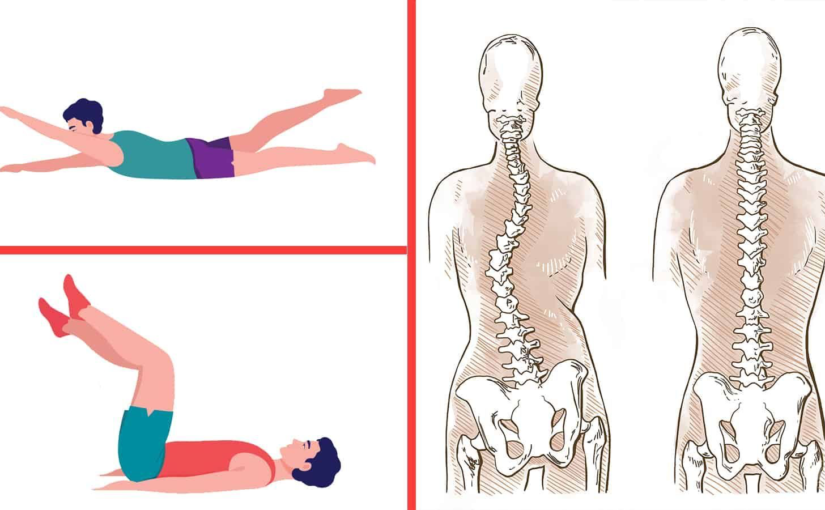 Physical exercise may prevent scoliosis progression- Study confirms