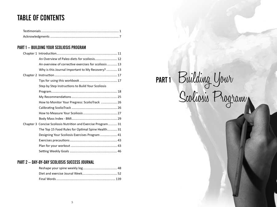 Scoliosis-treatment