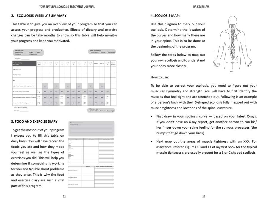 Scoliosis-treatment
