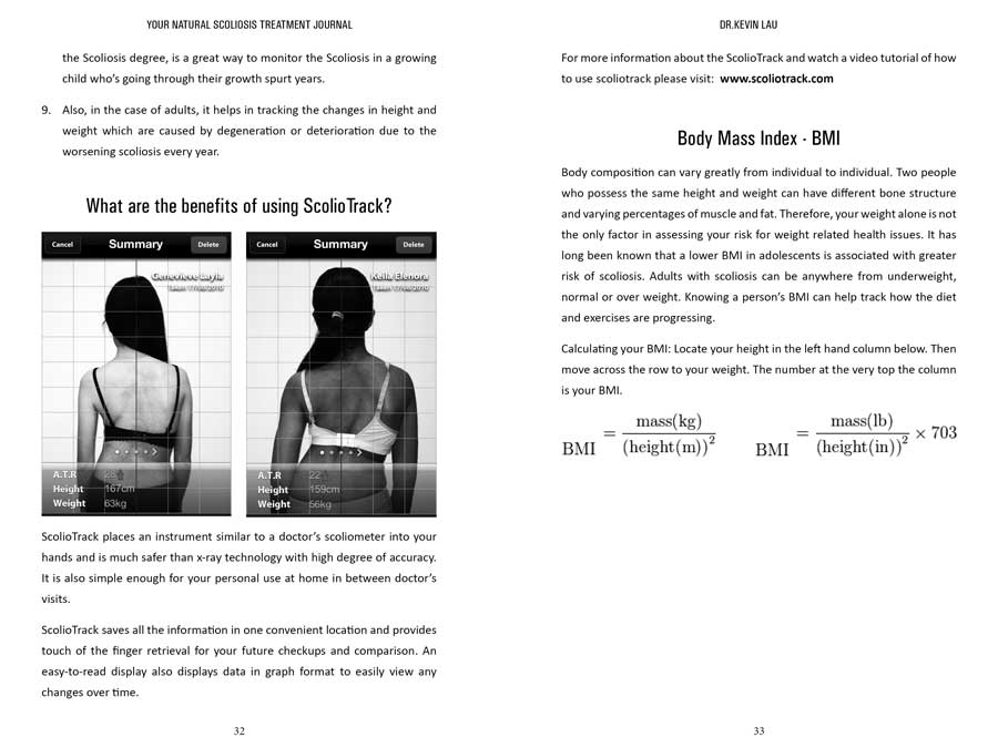 Scoliosis-treatment
