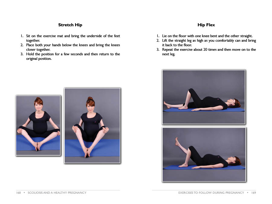 Pregnancy And Scoliosis Book