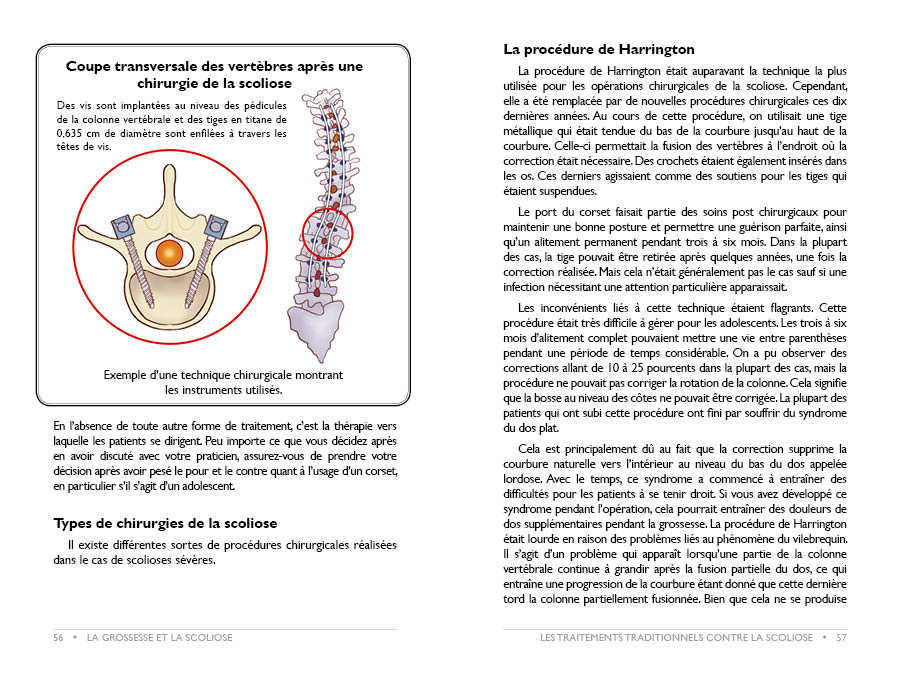 Livre Grossesse et Scoliose