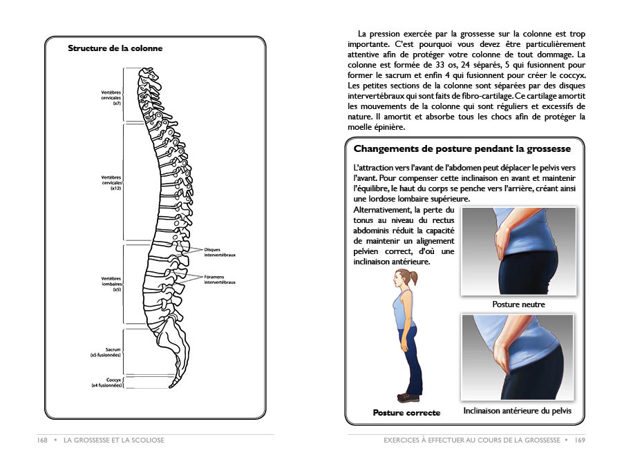 Livre Grossesse et Scoliose