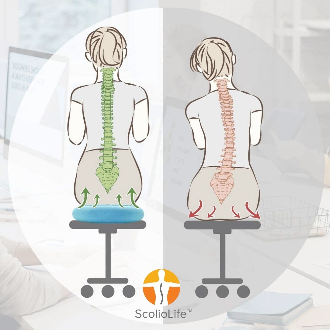 ScolioDisc active-sitting balance disc