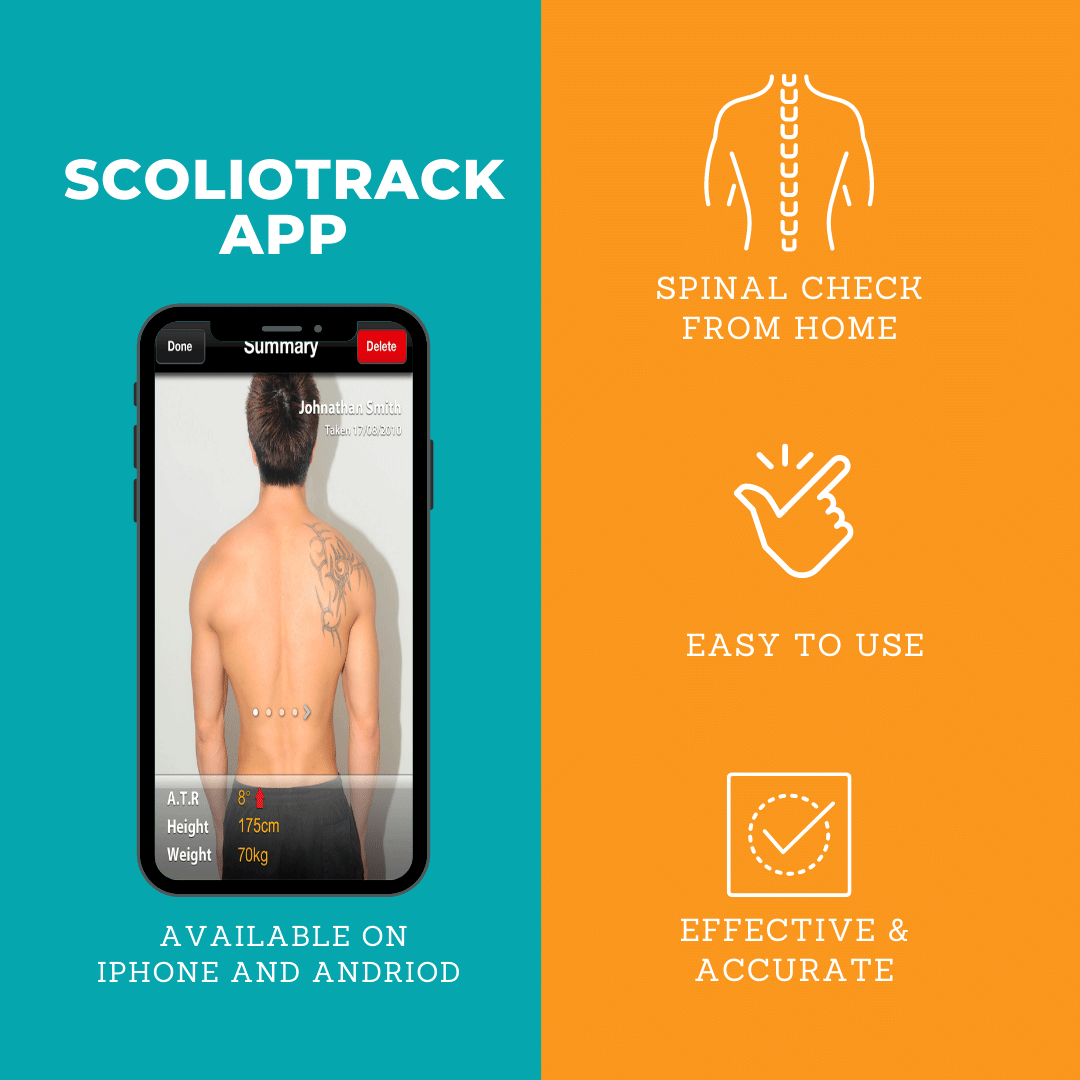 App ScolioTrack screen