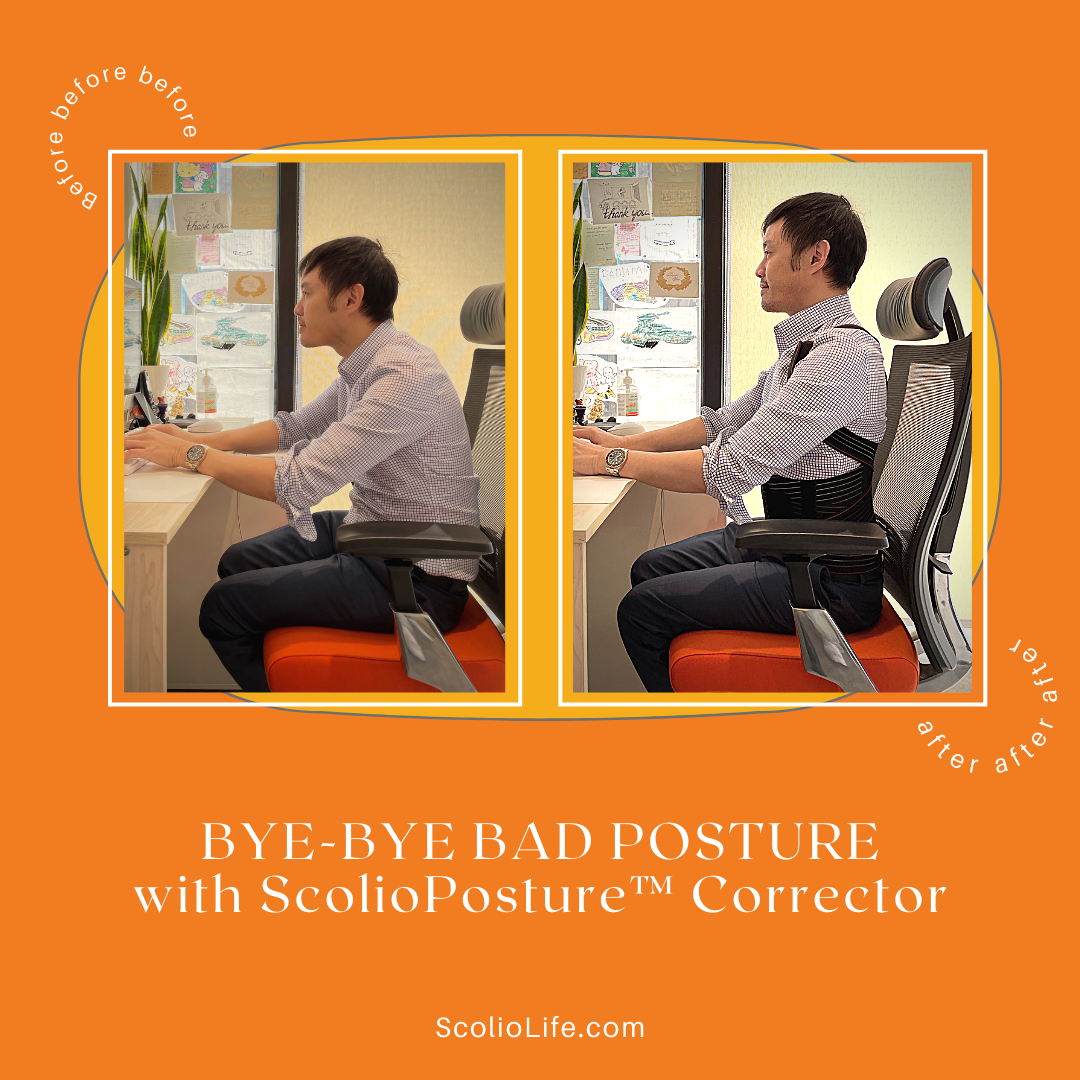 Good posture versus slouched posture comparison