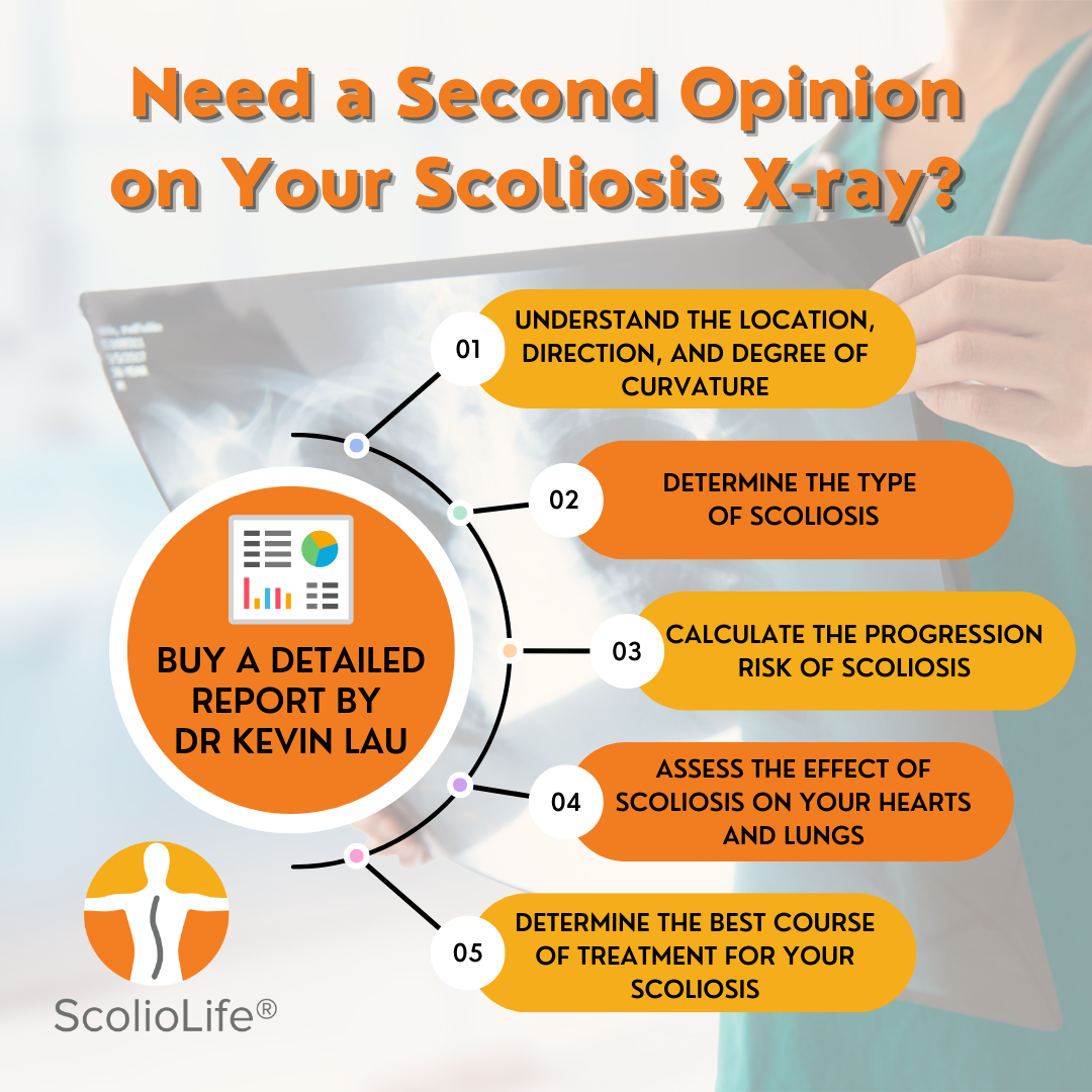 Scoliosis-X-Rays