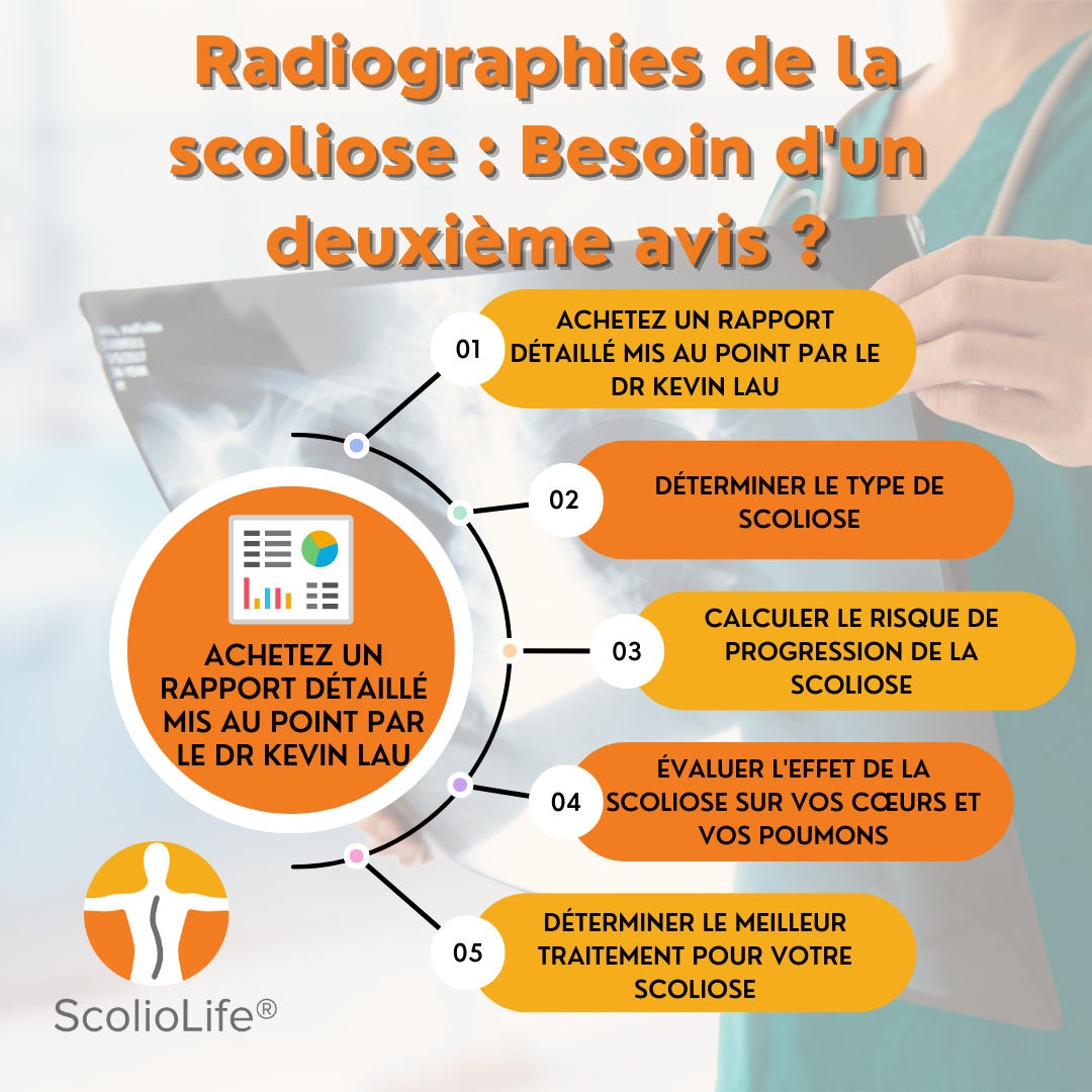Scoliosis-X-Rays