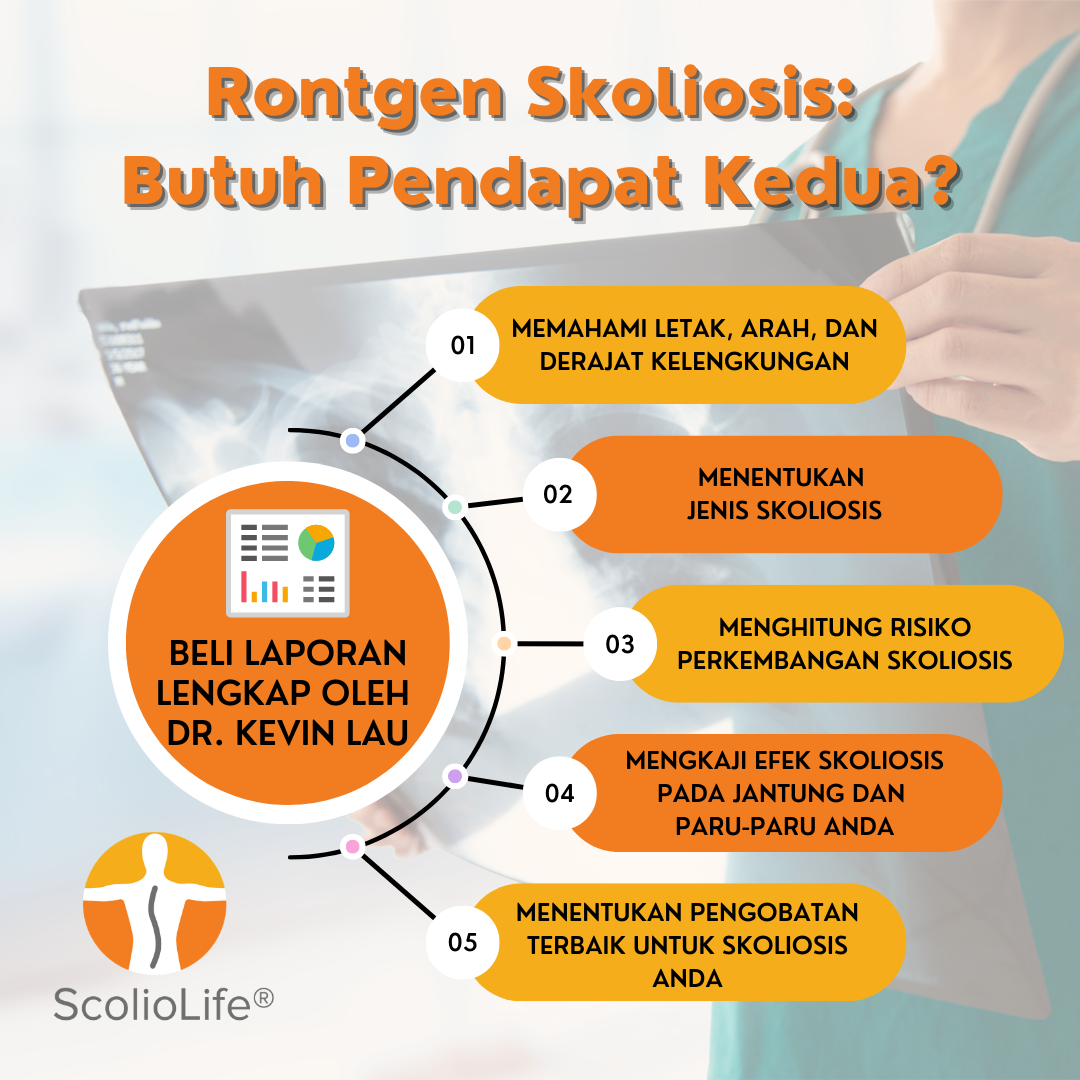Scoliosis-X-Rays