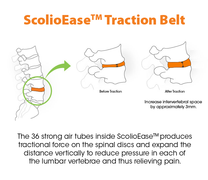 ScolioEase Traction Belt air-column illustration