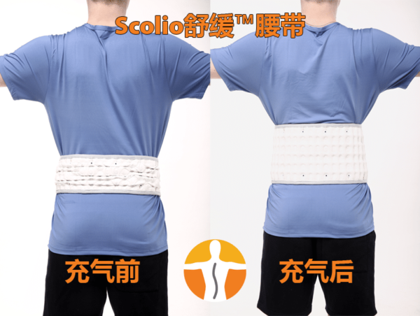 ScolioEase™ Traction Belt