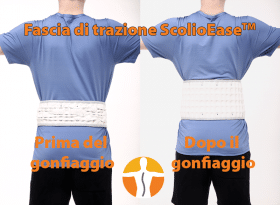 ScolioEase™ Traction Belt