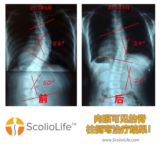 Xrays-before-and-after-07-CN