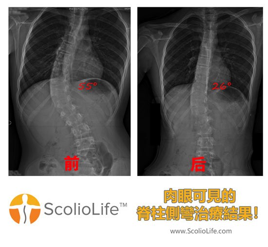 Xrays-before-and-after-10-CN