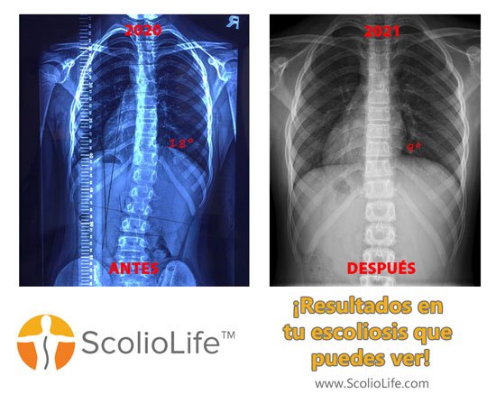 Xrays before and after 93
