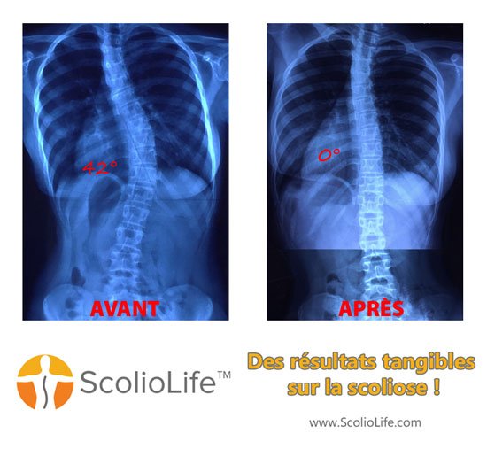 Xrays-before-and-after-18-FR
