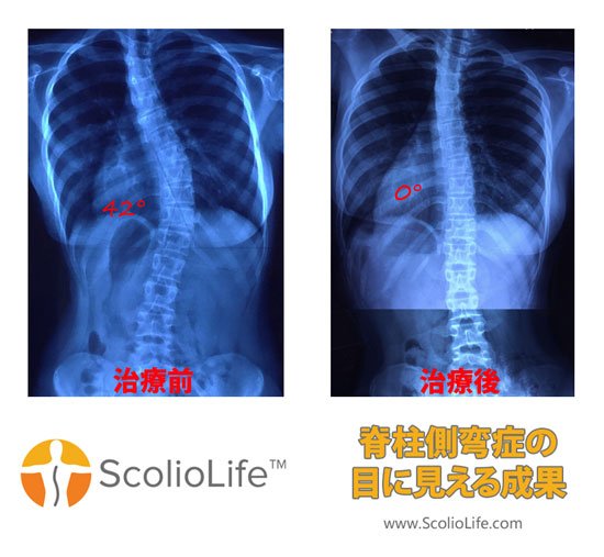 Xrays-before-and-after-18-JP
