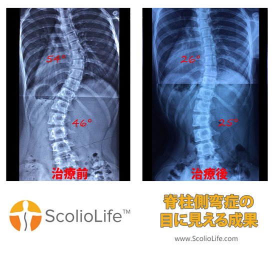 Xrays-before-and-after-19-JP