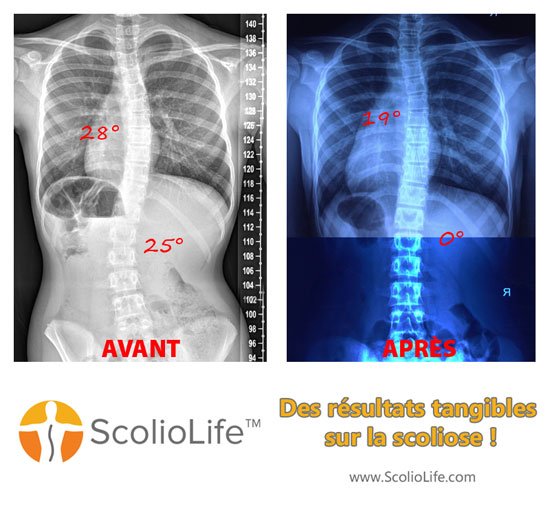 Xrays-before-and-after-20-FR