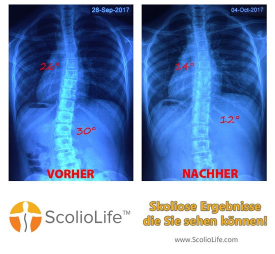 Xrays-before-and-after-21-DE
