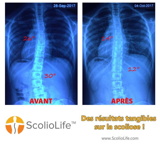 Xrays-before-and-after-21-FR