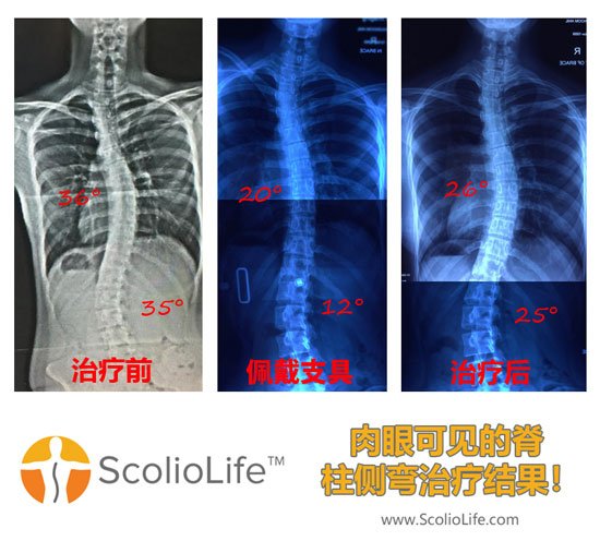 Xrays-before-and-after-22-CN