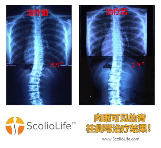 Xrays-before-and-after-23-CN