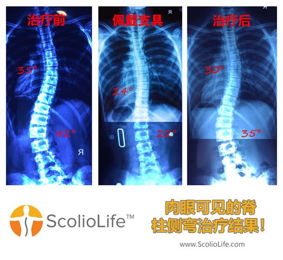 Xrays-before-and-after-24-CN