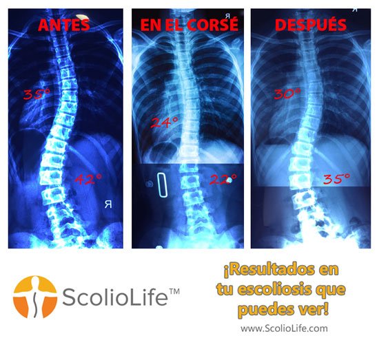 Xrays-before-and-after-24-ES