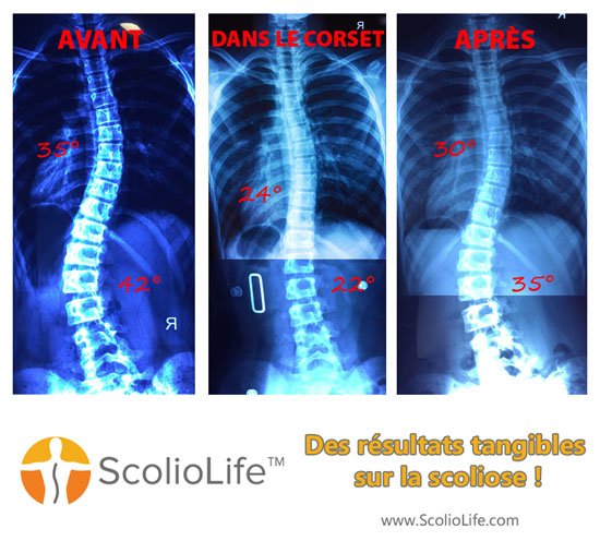 Xrays-before-and-after-24-FR