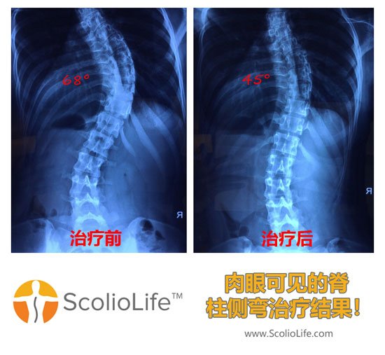 Xrays-before-and-after-25-CN