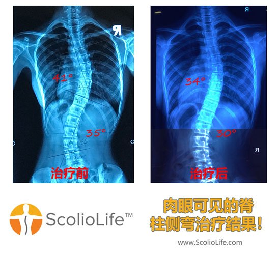 Xrays-before-and-after-26-CN