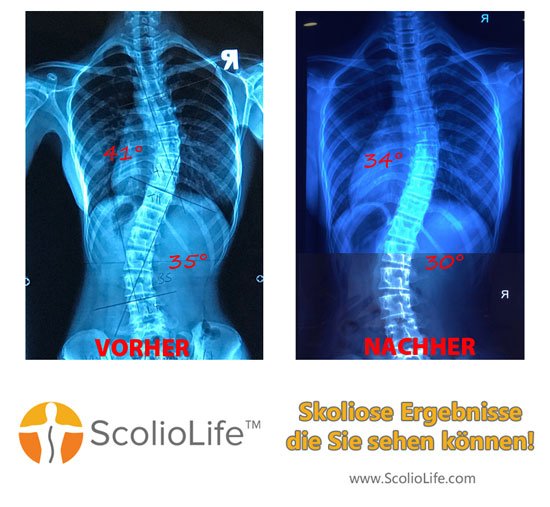 Xrays-before-and-after-26-DE