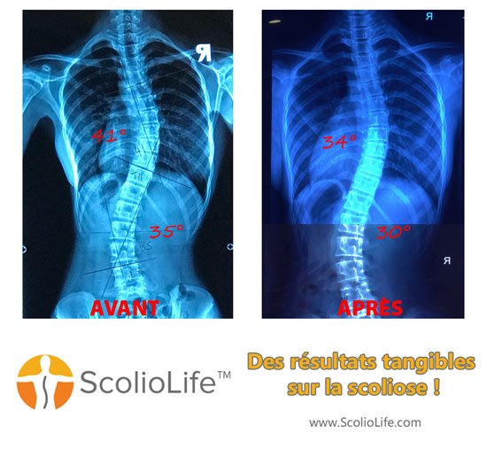 Xrays-before-and-after-26-FR