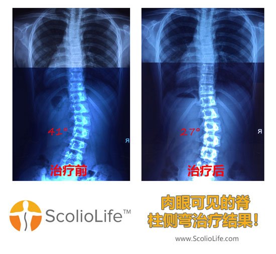 Xrays-before-and-after-27-CN