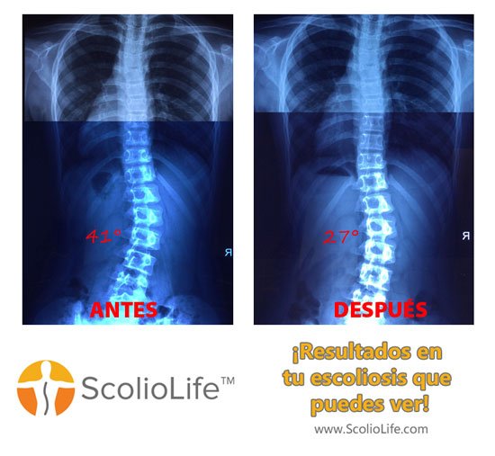Xrays-before-and-after-27-ES