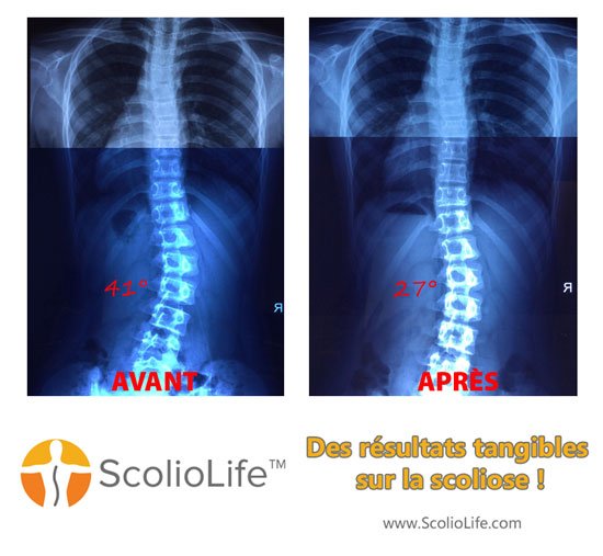 Xrays-before-and-after-27-FR