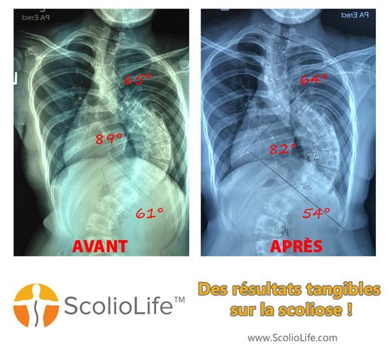 Xrays-before-and-after-28-FR