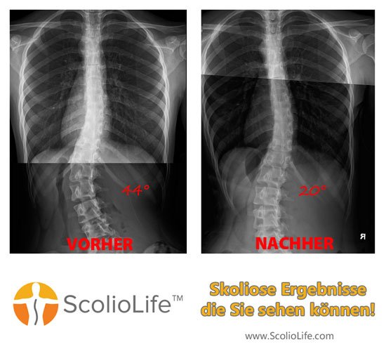 Xrays before and after 29 DE