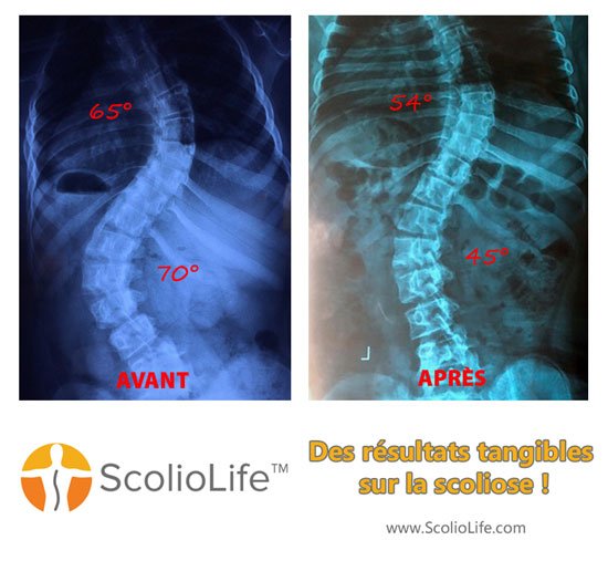 Xrays before and after 37 FR