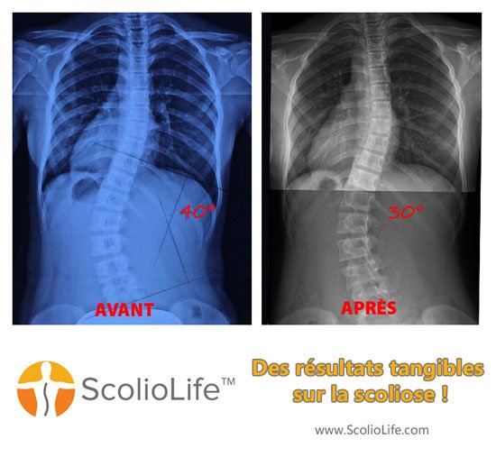 Xrays before and after 39 FR