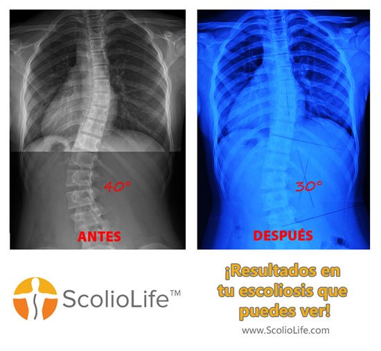 Xrays before and after 48 ES