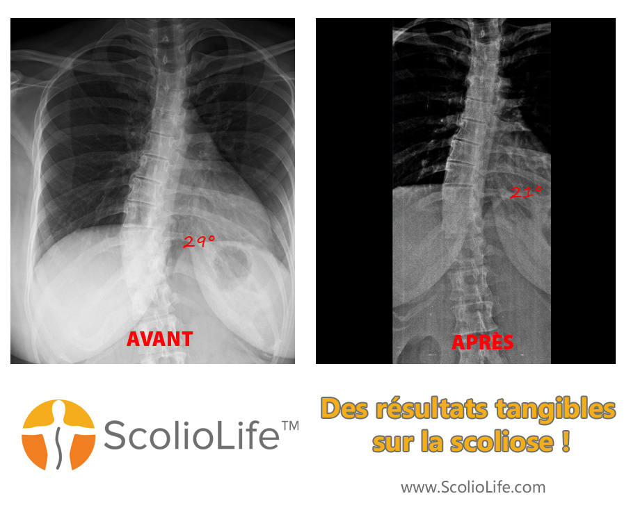 Xrays before and after 110